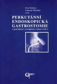 Perkutánní endoskopická gastrostomie a její místo v algoritmu umělé výživy