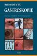 Gastroskopie