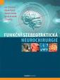 Funkční stereotaktická neurochirurgie