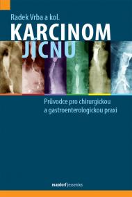 Karcinom jícnu - Průvodce pro chirurgickou a gastroenterologickou praxi