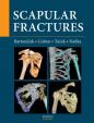 Scapular fractures