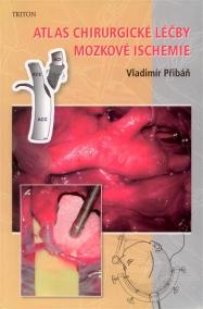 Atlas chirurgické léčby mozkové ischemie