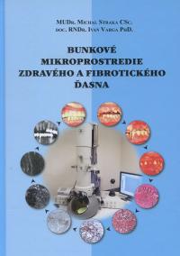 Bunkové mikroprostredie zdravého a fibrotického ďasna